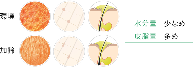 ドライ傾オイリースキン