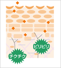 バリア機能の低下