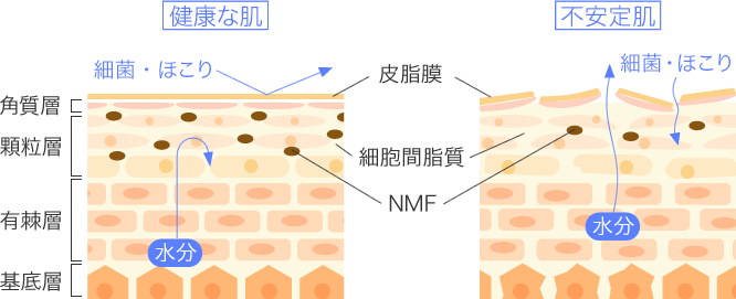 健康な肌と不安定肌