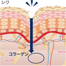 コラーゲンの減少でシワが発生