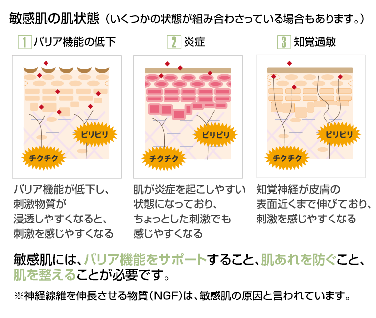 敏感肌とは